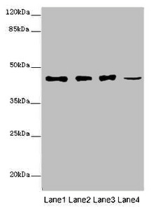 SIRPB1 / CD172b Antibody - Western blot All Lanes: SIRPB1 antibody at 6 ug/ml Lane 1: A549 whole cell lysate Lane 2: PC-3 whole cell lysate Lane 3: A375 whole cell lysate Lane 4: Mouse heart tissue Secondary Goat polyclonal to rabbit IgG at 1/10000 dilution Predicted band size: 44,20 kDa Observed band size: 43 kDa