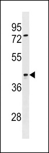 SIRPB2 Antibody - SIRPB2 Antibody western blot of ZR-75-1 cell line lysates (35 ug/lane). The SIRPB2 antibody detected the SIRPB2 protein (arrow).