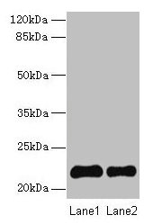 SIRPD Antibody - Western blot All lanes: Signal-regulatory protein delta antibody at 14µg/ml Lane 1: 293T whole cell lysate Lane 2: Mouse spleen tissue Secondary Goat polyclonal to rabbit IgG at 1/10000 dilution Predicted band size: 22 kDa Observed band size: 22 kDa