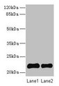 SIRPD Antibody - Western blot All lanes: Signal-regulatory protein delta antibody at 14µg/ml Lane 1: 293T whole cell lysate Lane 2: Mouse spleen tissue Secondary Goat polyclonal to rabbit IgG at 1/10000 dilution Predicted band size: 22 kDa Observed band size: 22 kDa