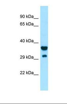 SIRPG Antibody - Western blot of Human ACHN. SIRPG antibody dilution 1.0 ug/ml.  This image was taken for the unconjugated form of this product. Other forms have not been tested.