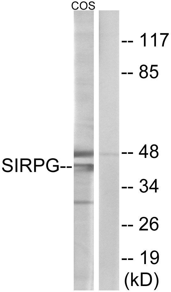 SIRPG Antibody - Western blot analysis of lysates from COS cells, using SIRPG Antibody. The lane on the right is blocked with the synthesized peptide.