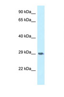 SIRPG Antibody - SIRPG antibody Western blot of 293T Cell lysate. Antibody concentration 1 ug/ml.  This image was taken for the unconjugated form of this product. Other forms have not been tested.