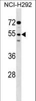 SIRPG Antibody - SIRPG Antibody western blot of NCI-H292 cell line lysates (35 ug/lane). The SIRPG antibody detected the SIRPG protein (arrow).