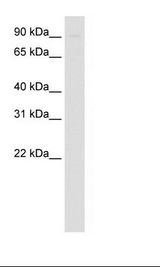 SIRT1 / Sirtuin 1 Antibody - Fetal Thymus Lysate.  This image was taken for the unconjugated form of this product. Other forms have not been tested.