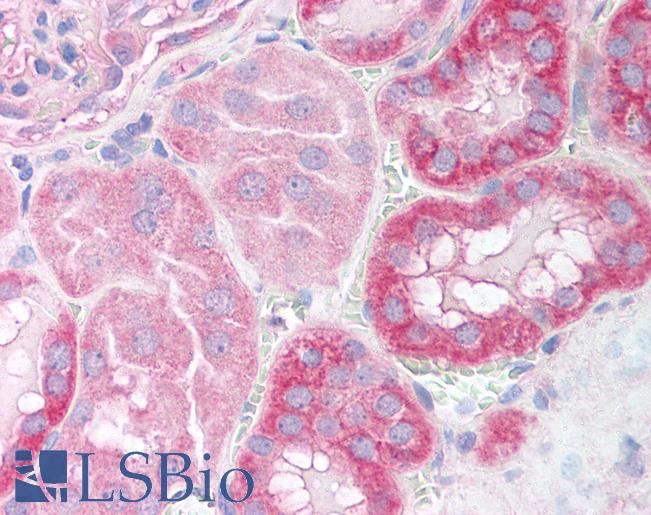 SIRT1 / Sirtuin 1 Antibody - Kidney: Formalin-Fixed Paraffin-Embedded (FFPE).  This image was taken for the unconjugated form of this product. Other forms have not been tested.