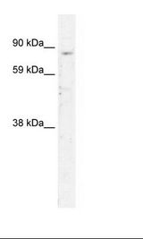 SIRT1 / Sirtuin 1 Antibody - Fetal Thymus Lysate.  This image was taken for the unconjugated form of this product. Other forms have not been tested.