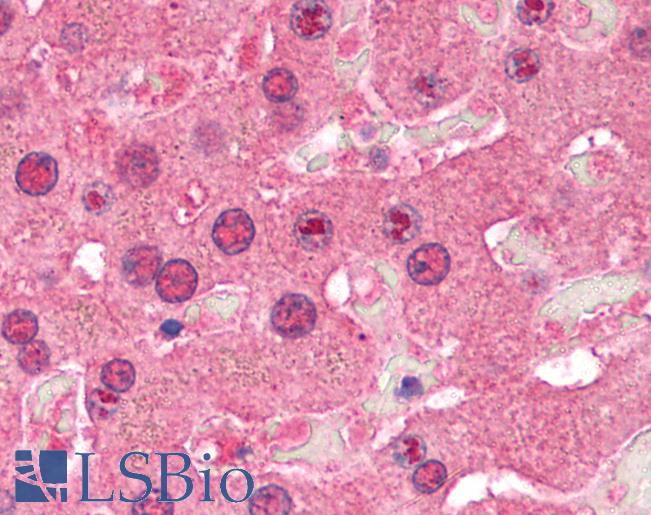 SIRT1 / Sirtuin 1 Antibody - Anti-SIRT1 antibody IHC of human liver. Immunohistochemistry of formalin-fixed, paraffin-embedded tissue after heat-induced antigen retrieval. Antibody concentration 5 ug/ml.  This image was taken for the unconjugated form of this product. Other forms have not been tested.