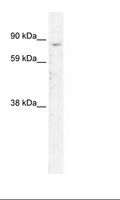 SIRT1 / Sirtuin 1 Antibody - Fetal Thymus Lysate.  This image was taken for the unconjugated form of this product. Other forms have not been tested.