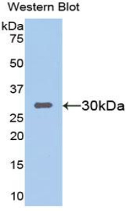 SIRT1 / Sirtuin 1 Antibody - Western blot of recombinant SIRT1 / Sirtuin 1.  This image was taken for the unconjugated form of this product. Other forms have not been tested.