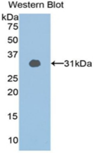 SIRT1 / Sirtuin 1 Antibody - Western blot of recombinant SIRT1 / Sirtuin 1.  This image was taken for the unconjugated form of this product. Other forms have not been tested.