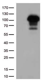 SIRT1 / Sirtuin 1 Antibody - HEK293T cells were transfected with the pCMV6-ENTRY control. (Left lane) or pCMV6-ENTRY SIRT1. (Right lane) cDNA for 48 hrs and lysed. Equivalent amounts of cell lysates. (5 ug per lane) were separated by SDS-PAGE and immunoblotted with anti-SIRT1. (1:2000)