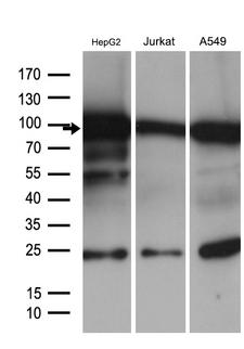 SIRT1 / Sirtuin 1 Antibody - Western blot analysis of extracts. (35ug) from 3 different cell lines by using anti-SIRT1 monoclonal antibody. (1:500)