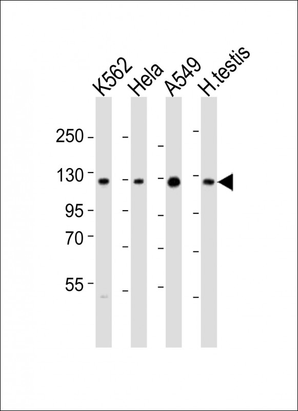SIRT1 / Sirtuin 1 Antibody - All lanes : Anti-SIRT1 Antibody at 1:2000 dilution Lane 1: K562 whole cell lysates Lane 2: HeLa whole cell lysates Lane 3: A549 whole cell lysates Lane 4: human testis lysates Lysates/proteins at 20 ug per lane. Secondary Goat Anti-Rabbit IgG, (H+L), Peroxidase conjugated at 1/10000 dilution Predicted band size : 82 kDa Blocking/Dilution buffer: 5% NFDM/TBST.