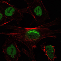 SIRT1 / Sirtuin 1 Antibody - Immunofluorescence of NTERA-2 cells using SIRT1 mouse monoclonal antibody (green). Red: Actin filaments have been labeled with Alexa Fluor-555 phalloidin.