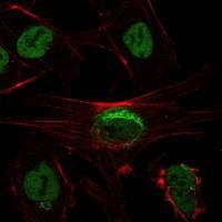 SIRT1 / Sirtuin 1 Antibody - Immunocytochemistry/Immunofluorescence: SIRT1 Antibody (1F3) - Analysis of NTERA-2 cells using SIRT1 mouse mAb (green). Red: Actin filaments have been labeled with Alexa Fluor-555 phalloidin.