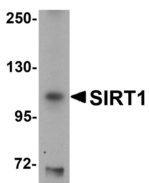 SIRT1 / Sirtuin 1 Antibody - Western blot analysis of SIRT1 in mouse liver tissue lysate with SIRT1 antibody at 1 ug/ml.