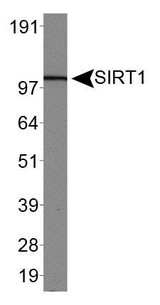 SIRT1 / Sirtuin 1 Antibody - Western Blot: SIRT1 Antibody - Analysis of SIRT1 in HeLa whole cell lysates.  This image was taken for the unconjugated form of this product. Other forms have not been tested.