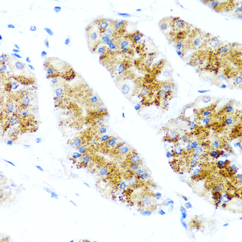 SIRT1 / Sirtuin 1 Antibody - Immunohistochemistry of formalin-fixed paraffin-embedded (FFPE) human stomach using SIRT1 antibody at dilution of 1:100 (40x magnification).