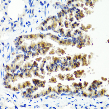 SIRT1 / Sirtuin 1 Antibody - Immunohistochemistry of paraffin-embedded mouse lung using SIRT1 antibodyat dilution of 1:100 (40x lens).