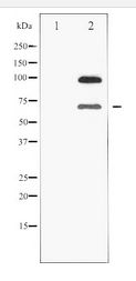 SIRT1 / Sirtuin 1 Antibody - Western blot of SirT1 expression in K562 whole cell lysates,The lane on the left is treated with the antigen-specific peptide.