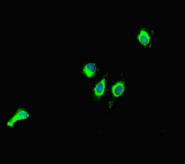 SIRT1 / Sirtuin 1 Antibody - Immunofluorescent analysis of HeLa cells diluted at 1:100 and Alexa Fluor 488-congugated AffiniPure Goat Anti-Rabbit IgG(H+L)
