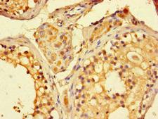 SIRT1 / Sirtuin 1 Antibody - Immunohistochemistry of paraffin-embedded human testis tissue at dilution of 1:100