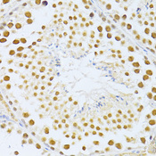 SIRT1 / Sirtuin 1 Antibody - Immunohistochemistry of paraffin-embedded mouse testis using SIRT1 antibody at dilution of 1:100 (40x lens).