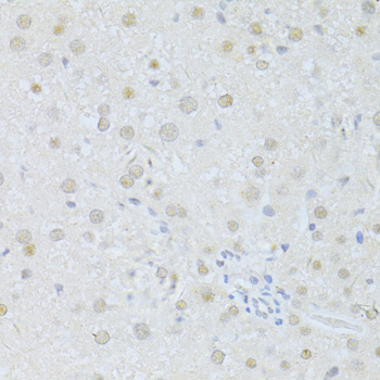 SIRT1 / Sirtuin 1 Antibody - Immunohistochemistry of paraffin-embedded rat liver using SIRT1 antibody at dilution of 1:100 (40x lens).