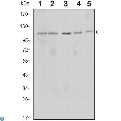 SIRT1 / Sirtuin 1 Antibody - Western Blot (WB) analysis using SIRT1 Monoclonal Antibody against MCF-7 (1), Jurkat (2), HeLa (3), HEK293 (4) and A549 (5) cell lysate.