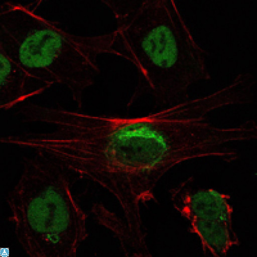 SIRT1 / Sirtuin 1 Antibody - Immunofluorescence (IF) analysis of NTERA-2 cells using SIRT1 Monoclonal Antibody (green). Red: Actin filaments have been labeled with Alexa Fluor-555 phalloidin.