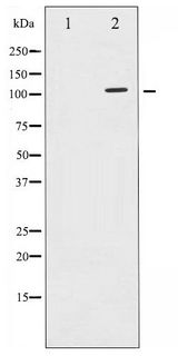 SIRT1 / Sirtuin 1 Antibody - Western blot of SirT1 phosphorylation expression in JK whole cell lysates,The lane on the left is treated with the antigen-specific peptide.