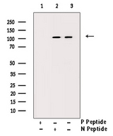 SIRT1 / Sirtuin 1 Antibody - Western blot analysis of Phospho-SirT1 (Ser47) antibody expression in JK cells lysates. The lane on the right is treated with the antigen-specific peptide.