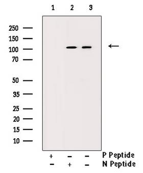 SIRT1 / Sirtuin 1 Antibody - Western blot analysis of Phospho-SirT1 (Ser47) antibody expression in JK cells lysates. The lane on the right is treated with the antigen-specific peptide.