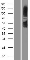 SIRT1 / Sirtuin 1 Protein - Western validation with an anti-DDK antibody * L: Control HEK293 lysate R: Over-expression lysate