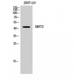 SIRT2 / Sirtuin 2 Antibody - Western blot of SIRT2 antibody