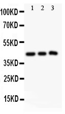 SIRT2 / Sirtuin 2 Antibody - SIRT2 antibody Western blot. All lanes: Anti SIRT2 at 0.5 ug/ml. Lane 1: Rat Spleen Tissue Lysate at 50 ug. Lane 2: HELA Whole Cell Lysate at 40 ug. Lane 3: A549 Whole Cell Lysate at 40 ug. Predicted band size: 43 kD . Observed band size: 43 kD.