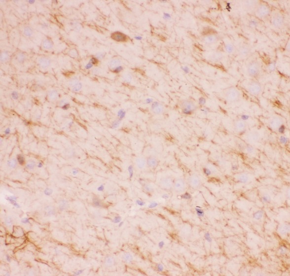 SIRT2 / Sirtuin 2 Antibody - SIRT2 antibody IHC-paraffin: Mouse Brain Tissue.