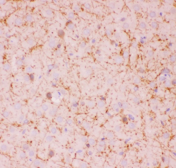 SIRT2 / Sirtuin 2 Antibody - SIRT2 antibody IHC-paraffin: Rat Brain Tissue.