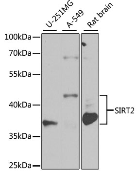 SIRT2 / Sirtuin 2 Antibody - Western blot analysis of extracts of various cell lines, using SIRT2 antibody at 1:1000 dilution. The secondary antibody used was an HRP Goat Anti-Rabbit IgG (H+L) at 1:10000 dilution. Lysates were loaded 25ug per lane and 3% nonfat dry milk in TBST was used for blocking. An ECL Kit was used for detection and the exposure time was 10s.