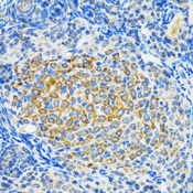 SIRT2 / Sirtuin 2 Antibody - Immunohistochemistry of paraffin-embedded rat ovary using SIRT2 antibodyat dilution of 1:100 (40x lens).