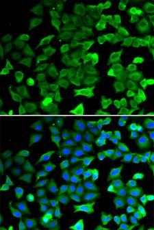 SIRT2 / Sirtuin 2 Antibody - Immunofluorescence analysis of HeLa cells using SIRT2 antibody. Blue: DAPI for nuclear staining.