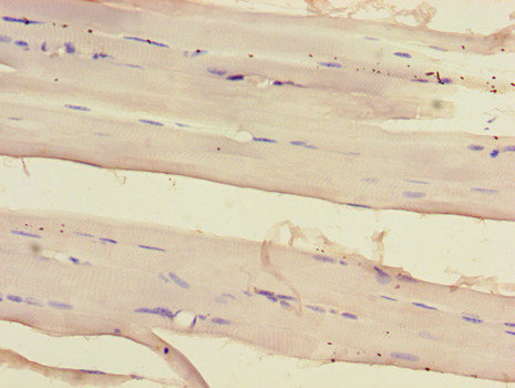 SIRT2 / Sirtuin 2 Antibody - Immunohistochemistry of paraffin-embedded human skeletal muscle tissue using SIRT2 Antibody at dilution of 1:100