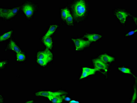 SIRT2 / Sirtuin 2 Antibody - Immunofluorescent analysis of Hela cells using SIRT2 Antibody at a dilution of 1:100 and Alexa Fluor 488-congugated AffiniPure Goat Anti-Rabbit IgG(H+L)