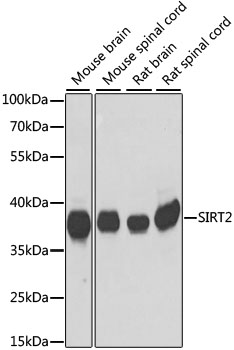 SIRT2 / Sirtuin 2 Antibody - Western blot analysis of extracts of various cell lines, using SIRT2 antibody at 1:1000 dilution. The secondary antibody used was an HRP Goat Anti-Rabbit IgG (H+L) at 1:10000 dilution. Lysates were loaded 25ug per lane and 3% nonfat dry milk in TBST was used for blocking. An ECL Kit was used for detection and the exposure time was 30s.