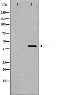 SIRT2 / Sirtuin 2 Antibody - Western blot analysis of SIRT2 expression in 293 cells. The lane on the left is treated with the antigen-specific peptide.