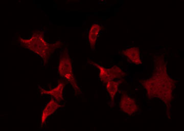 SIRT2 / Sirtuin 2 Antibody - Staining 293 cells by IF/ICC. The samples were fixed with PFA and permeabilized in 0.1% Triton X-100, then blocked in 10% serum for 45 min at 25°C. The primary antibody was diluted at 1:200 and incubated with the sample for 1 hour at 37°C. An Alexa Fluor 594 conjugated goat anti-rabbit IgG (H+L) Ab, diluted at 1/600, was used as the secondary antibody.