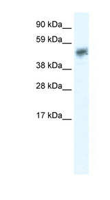 SIRT2 / Sirtuin 2 Antibody - SIRT2 antibody Western blot of Fetal brain lysate. This image was taken for the unconjugated form of this product. Other forms have not been tested.