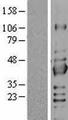 SIRT2 / Sirtuin 2 Protein - Western validation with an anti-DDK antibody * L: Control HEK293 lysate R: Over-expression lysate