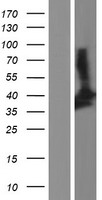 SIRT2 / Sirtuin 2 Protein - Western validation with an anti-DDK antibody * L: Control HEK293 lysate R: Over-expression lysate